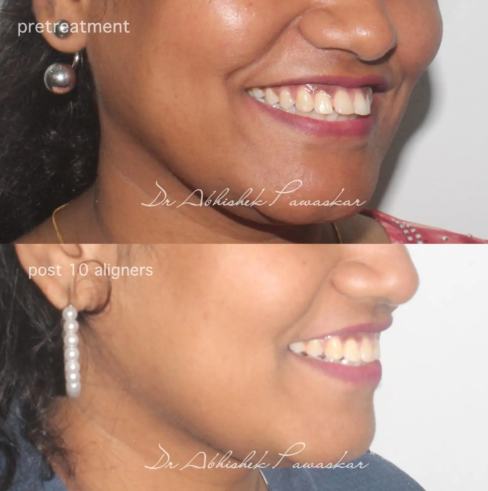 WhatsApp Image 2026-03-28 at 1.30.31 PM