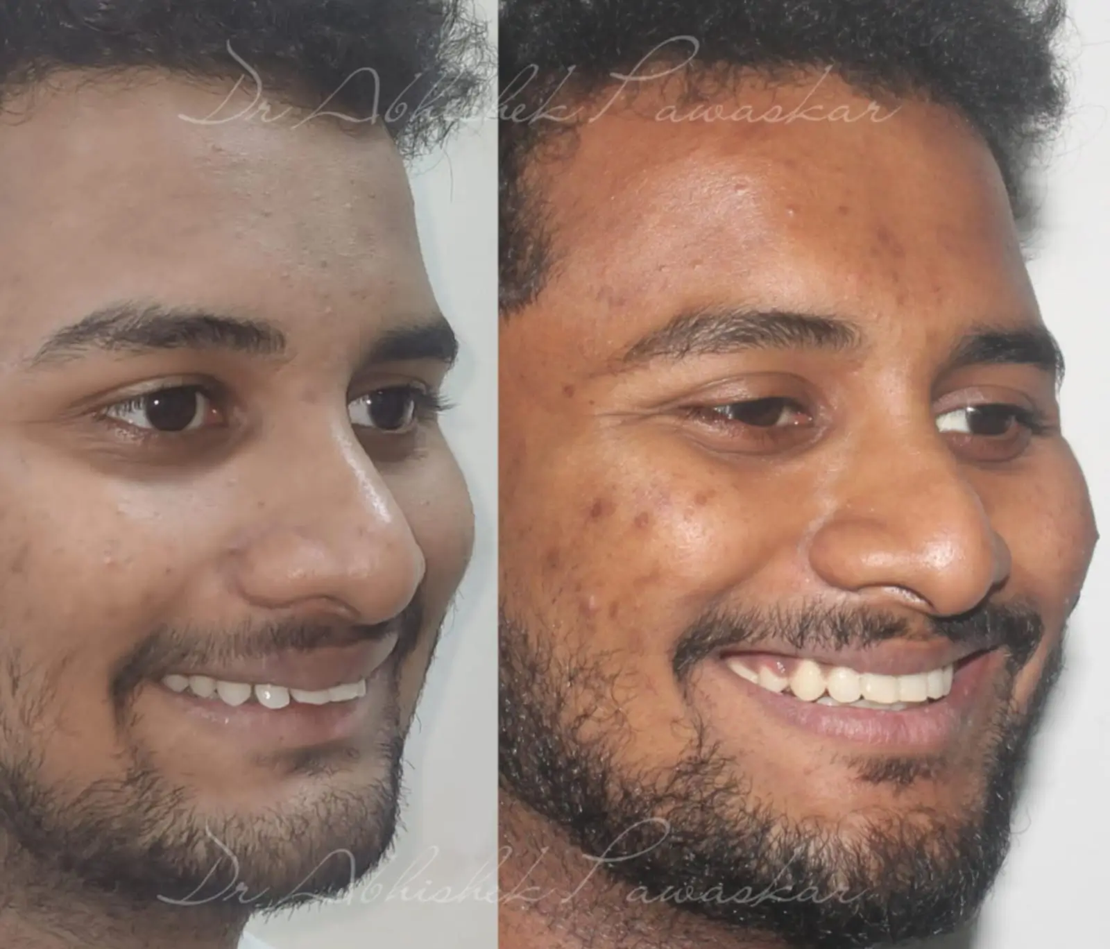 WhatsApp Image 2026-03-28 at 1.30.32 PM (1)