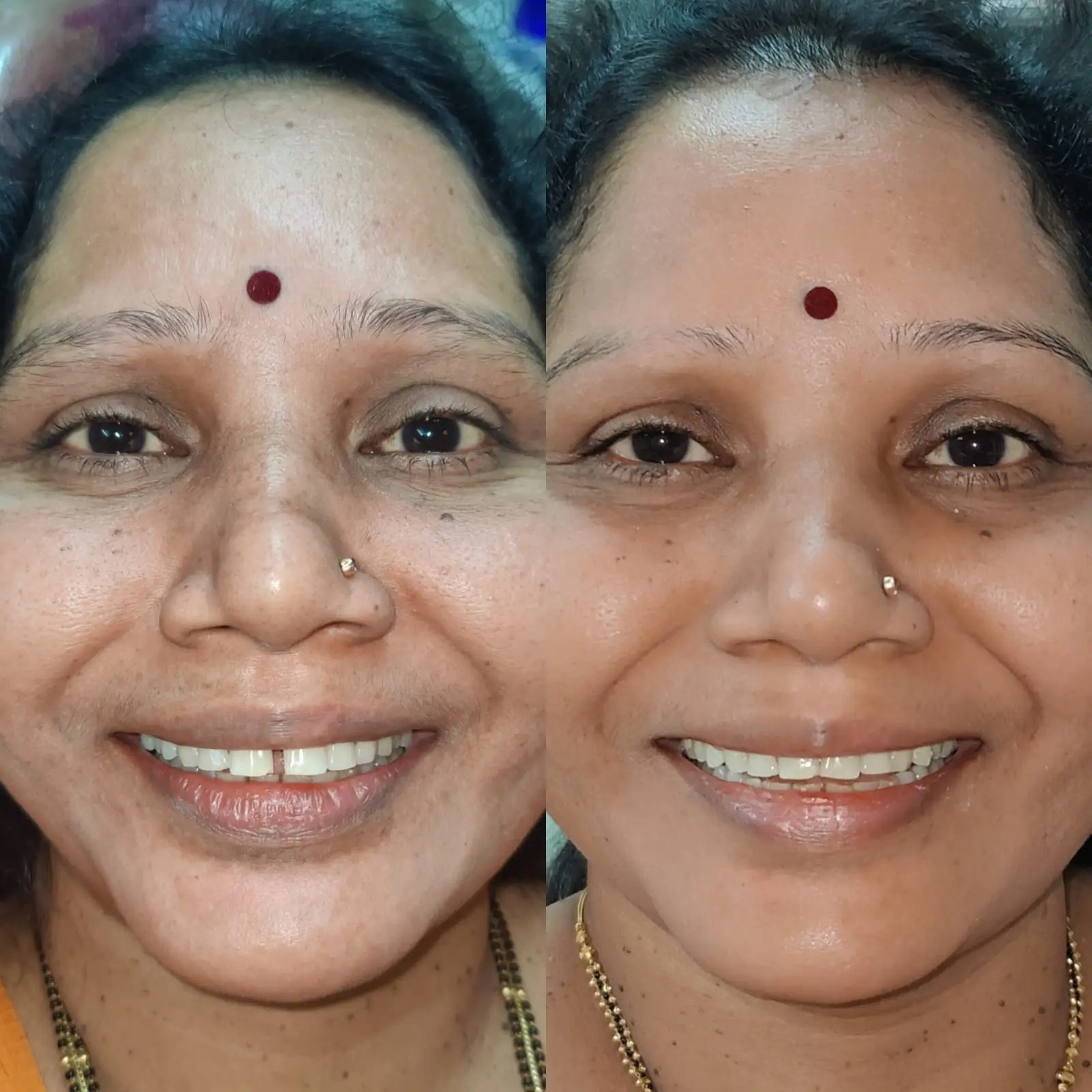 WhatsApp Image 2026-03-28 at 1.30.32 PM (2)